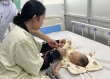 Bệnh tay chân miệng: Không lạm dụng thuốc, xét nghiệm gây tốn kém không cần thiết